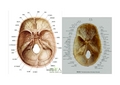 筛孔解剖图图片