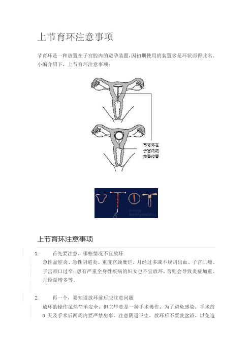 节育环是一种放置在子宫腔内的避孕装置,因初期使用的装置多是环状而