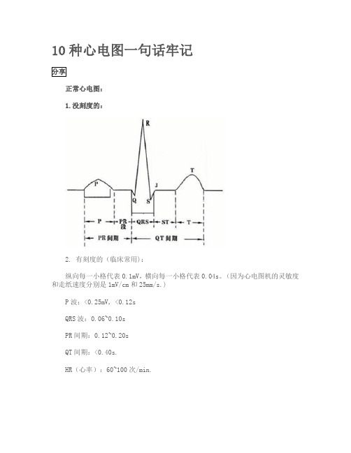 10種心電圖一句話牢記 分享正常心電圖: 1.沒刻度的: 2.