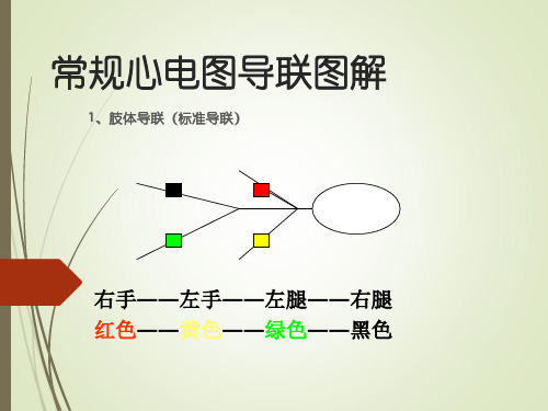 常规心电图导联图解 1,肢体导联(标准导联) 右手――左手――左腿――