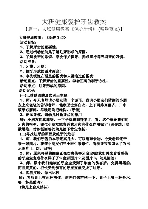 大班健康爱护牙齿教案 【篇一:大班健康教案《保护牙齿》(精选范文)】
